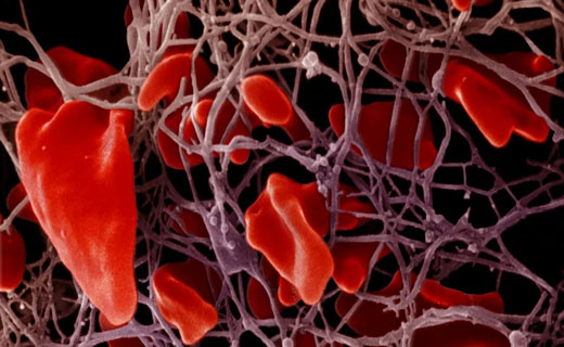 Найдены белки в крови, которые предсказывают развитие 67 заболеваний